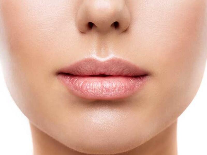 Botox - Lip lines in Javea