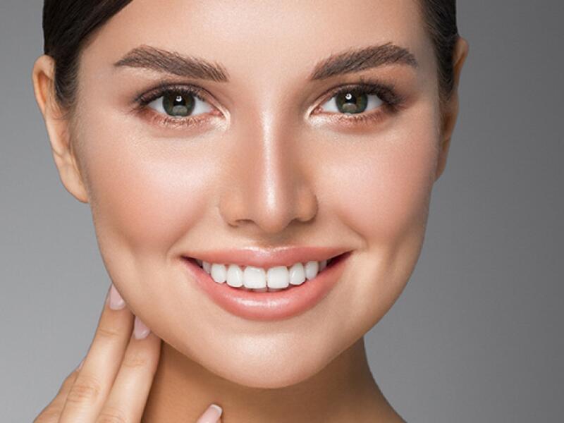 Cheek lines with botox in Javea