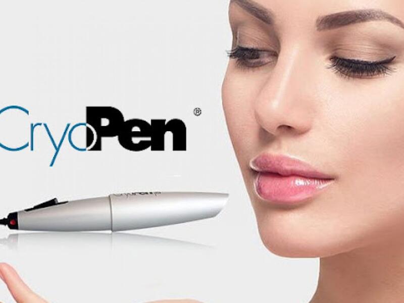 Cryopen/Cryotherapy in Javea