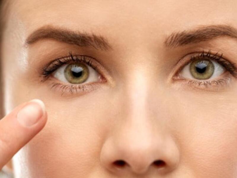 Dark circles with Fillers in Javea
