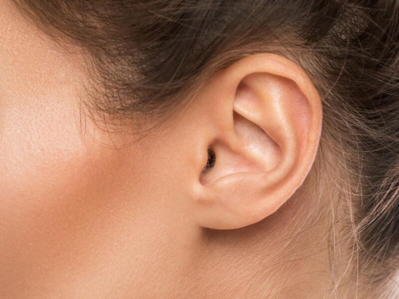 Earlobes with Filler in Javea