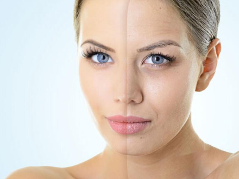 Mesotherapy in Javea