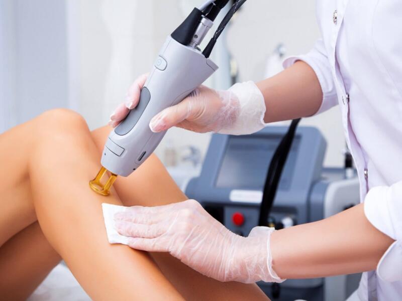 Permanent Laser Hair Removal in Javea