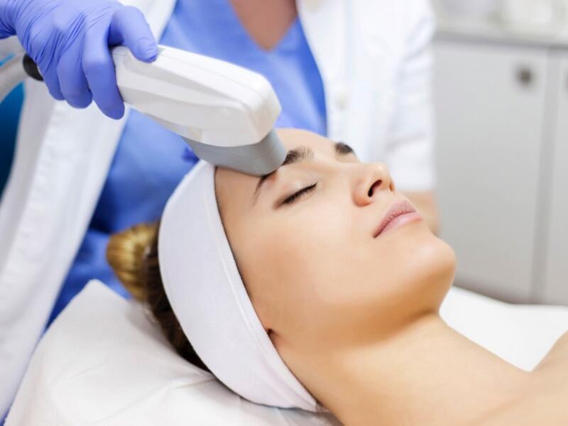 Photorejuvenation with IPL laser in Javea