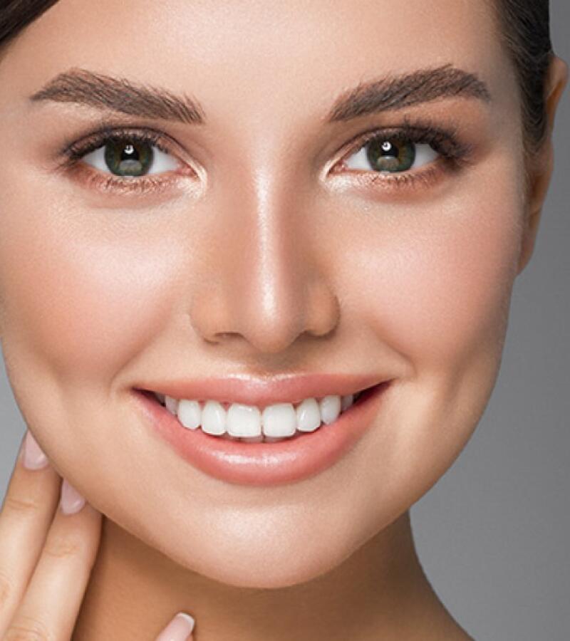 Cheek lines with botox in Javea