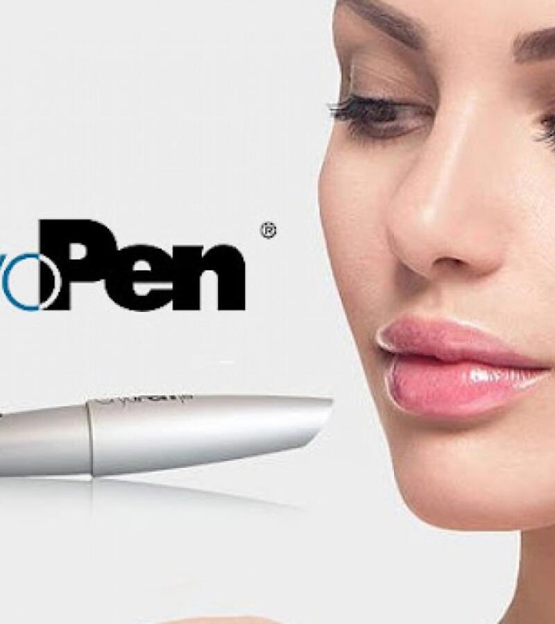 Cryopen/Cryotherapy in Javea