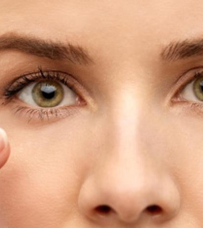 Dark circles with Fillers in Javea