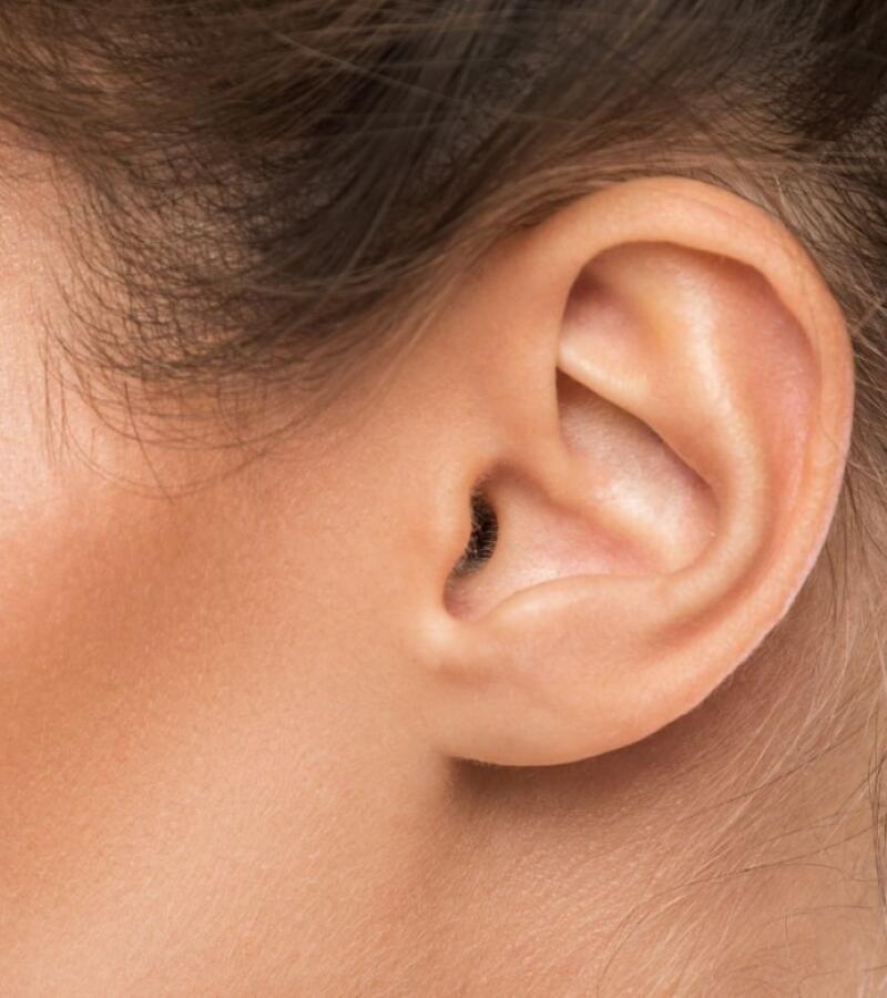 Earlobes with Filler in Javea