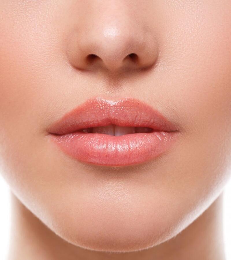 Enhance Your Lips with Fillers in Javea
