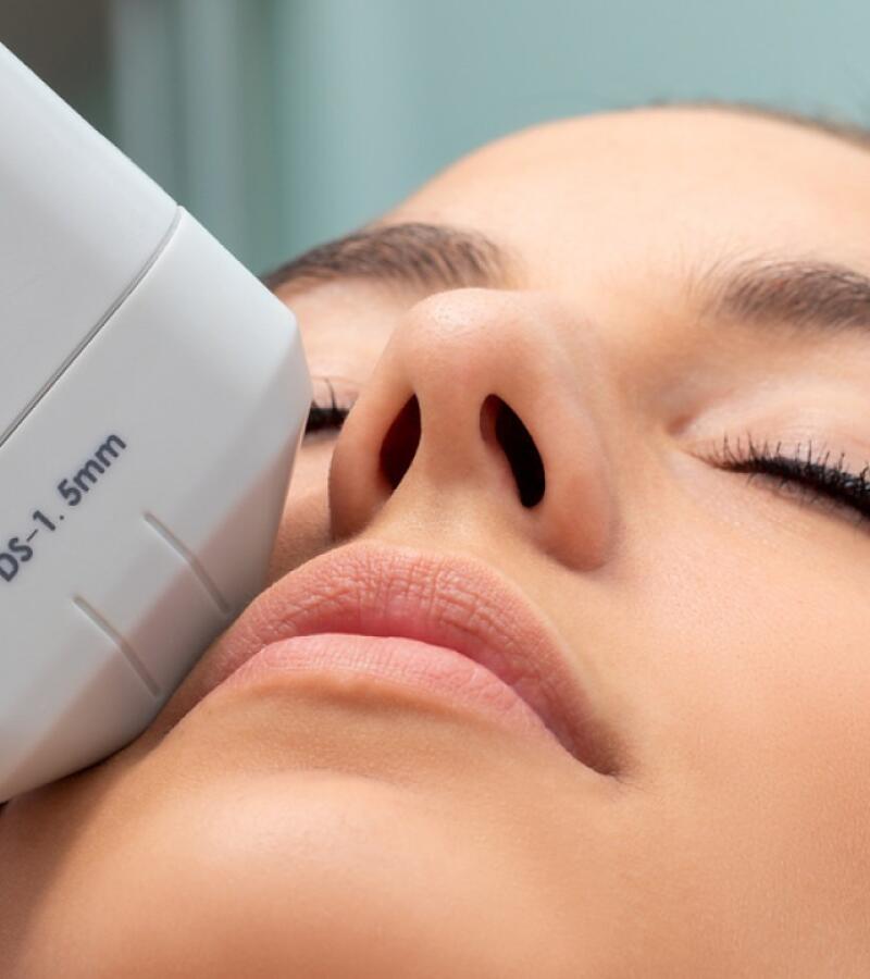 Facelift with HIFU in Javea
