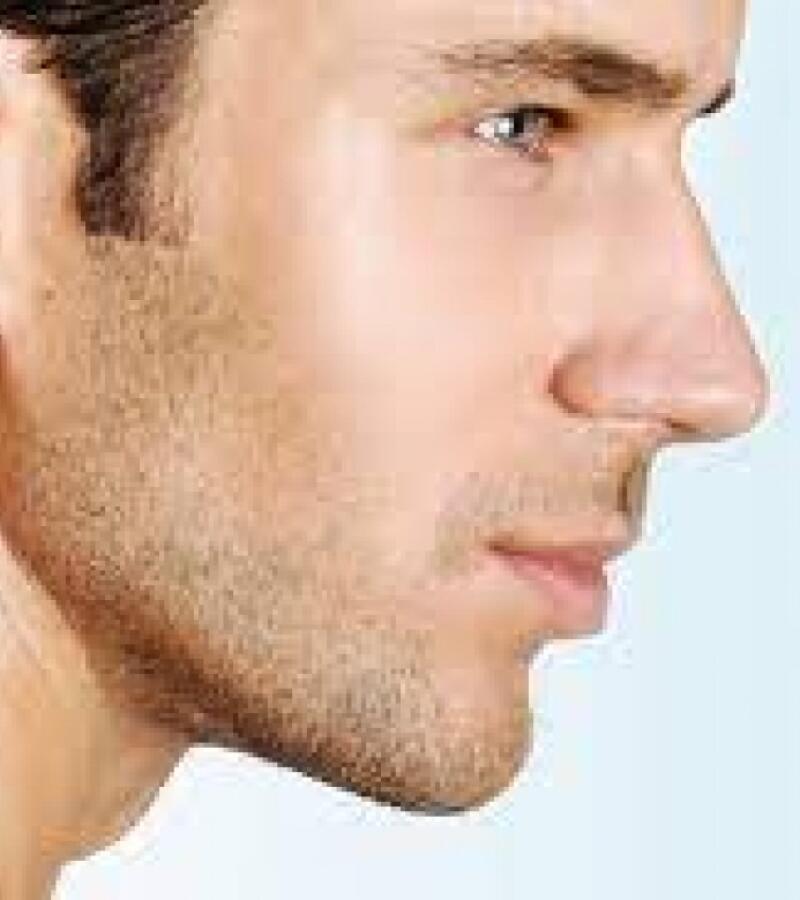 HIFU Skin Tightening for Men in Javea – Non-Surgical Face Lift