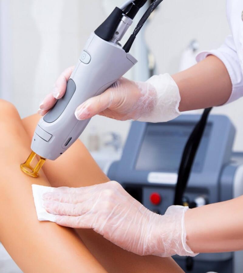 Permanent Laser Hair Removal in Javea – Safe and Effective Solution